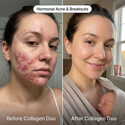 MilkyBump Collagen Duo