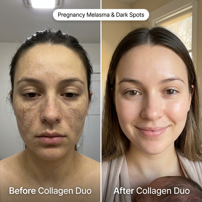 MilkyBump Collagen Duo