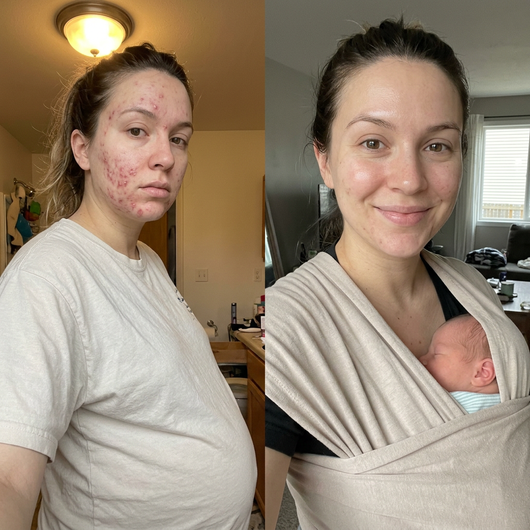 MilkyBump Collagen Duo